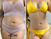 BODY SCULPTING