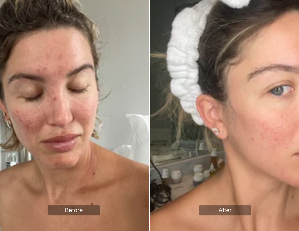 Skin Health