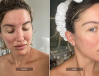 Skin Health