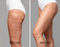 Body Texture